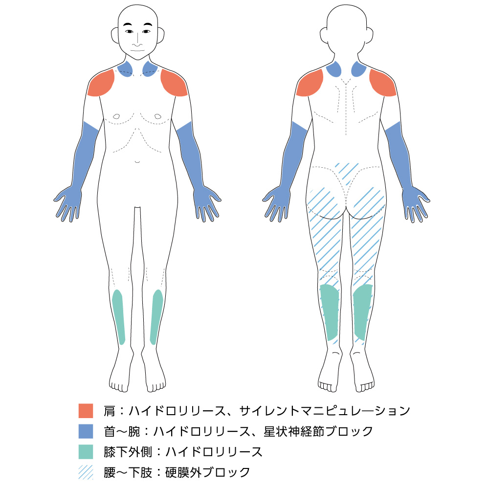 人体