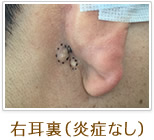 外見、内容物